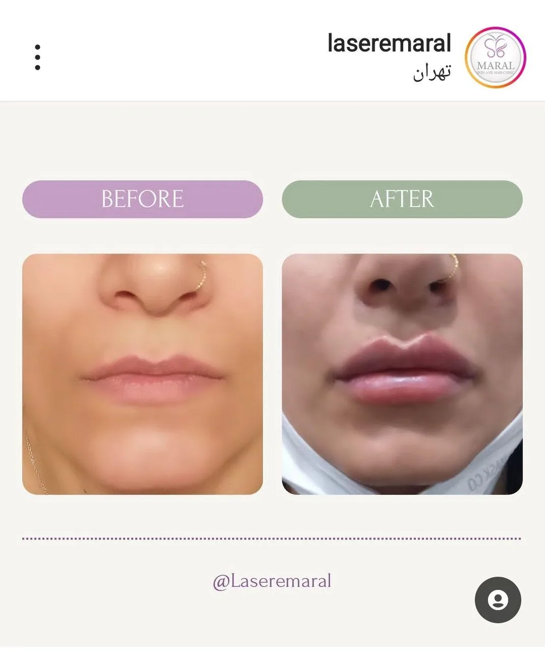 مجموعه زیبایی و لیزر پردیس مارال/مطب دکتر مرضیه پوراکبری - تصویر 2