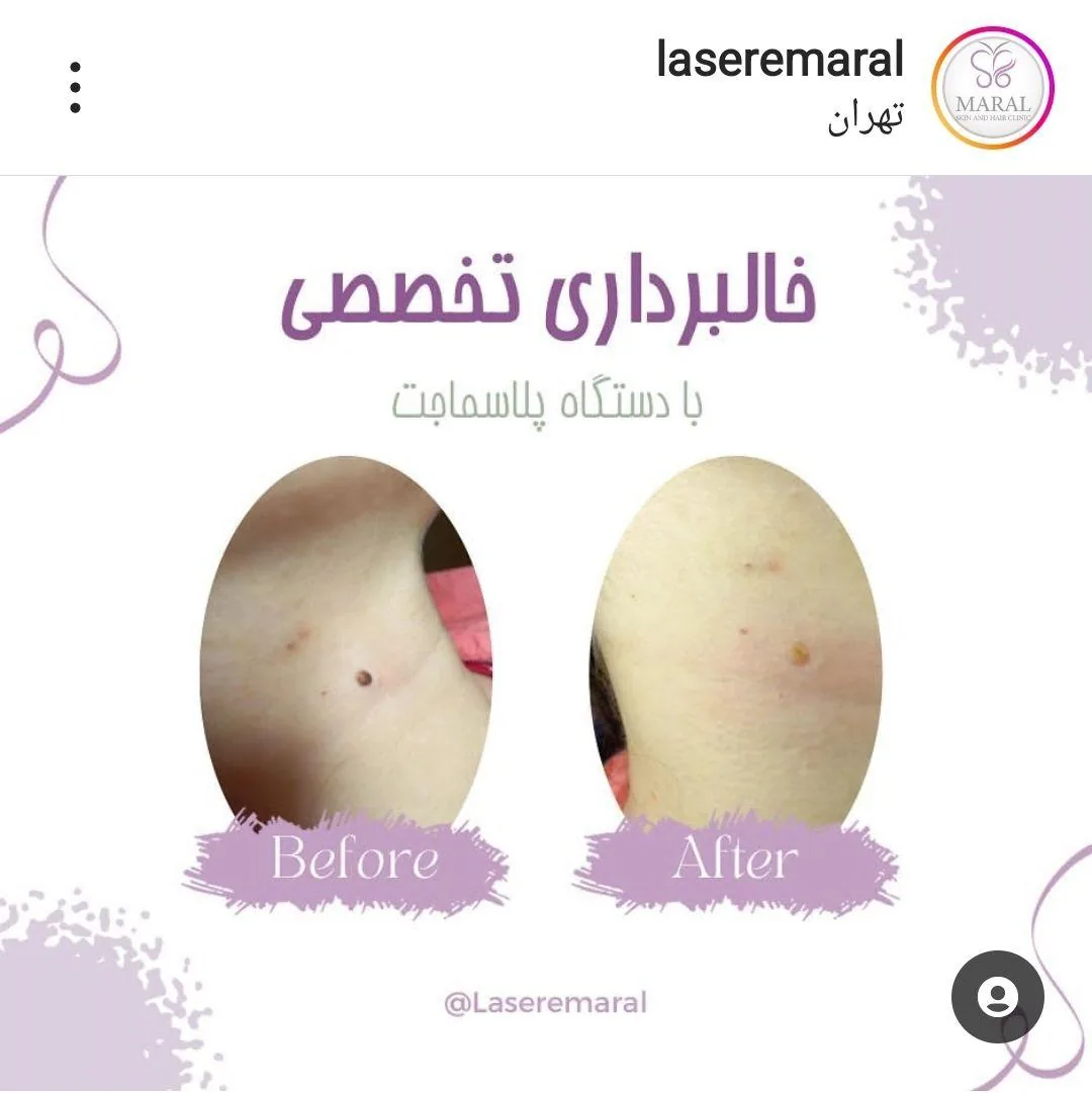مجموعه زیبایی و لیزر پردیس مارال/مطب دکتر مرضیه پوراکبری - تصویر 3