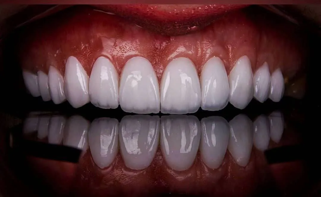 کلینیک تخصصی دندانپزشکی دکتر طبرستانی - تصویر 2