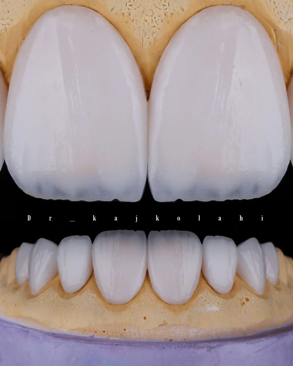 کلینیک تخصصی دندانپزشکی دکتر طبرستانی - تصویر 3