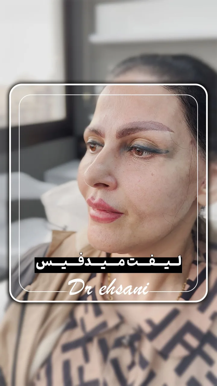کلینیک جراحی زیبایی دکتر محمدحسین احسانی - تصویر 2