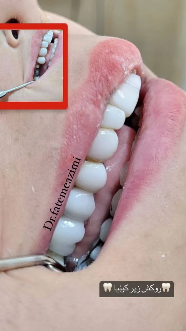 کلینیک دندانپزشکی دکتر فاطمه عظیمی - تصویر 4