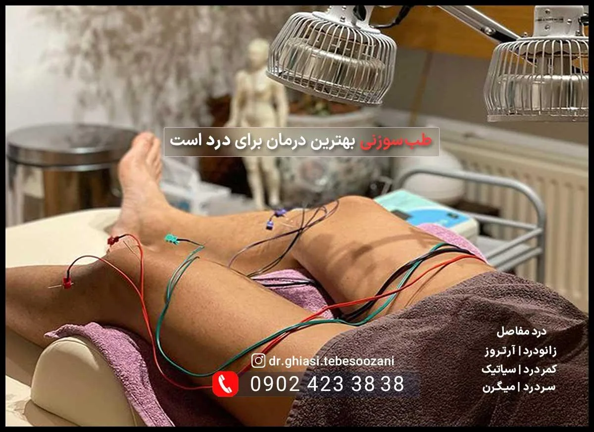 کلینیک طب سوزنی دکتر سمیه غیاثی - تصویر 2
