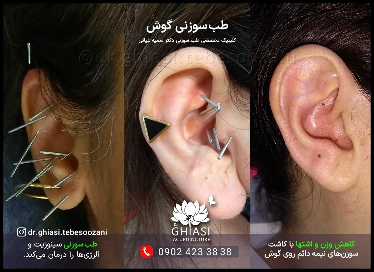 کلینیک طب سوزنی دکتر سمیه غیاثی - تصویر 3