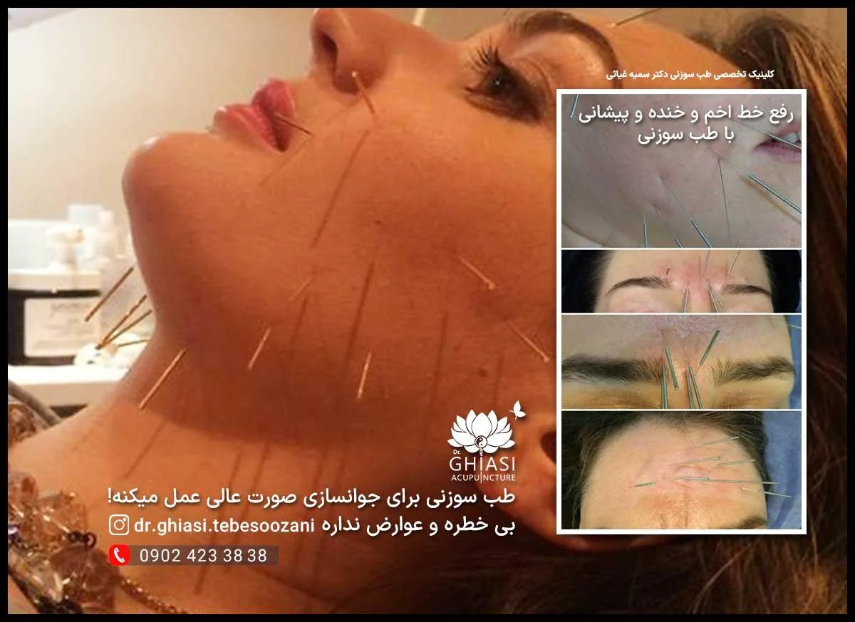 کلینیک طب سوزنی دکتر سمیه غیاثی - تصویر 4