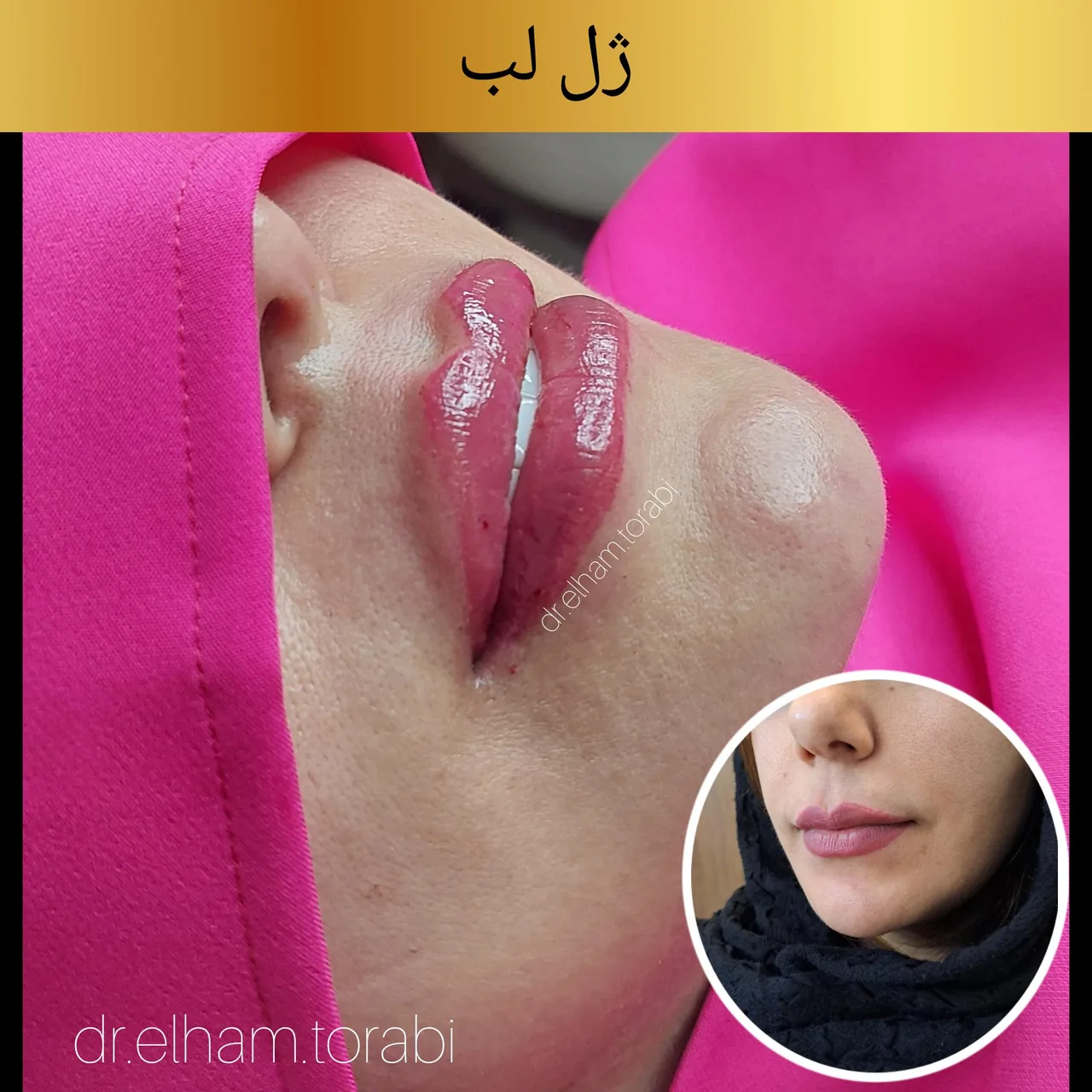 کلینیک لیزر و زیبایی دکتر الهام ترابی - تصویر 2