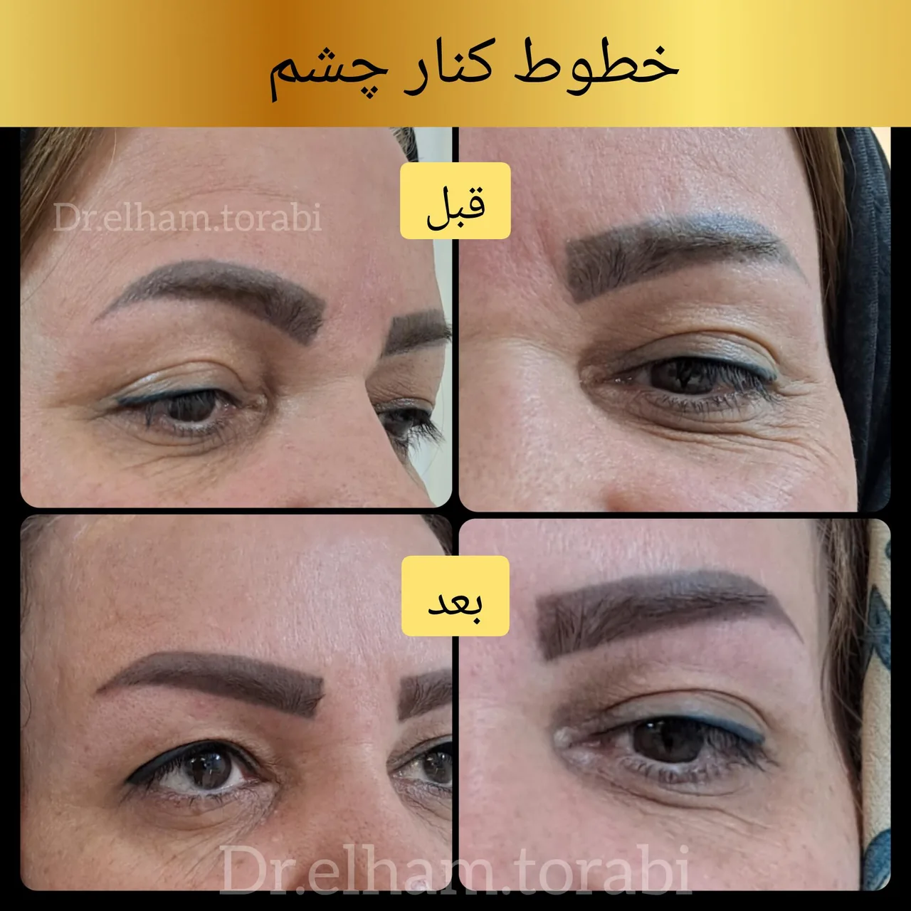 کلینیک لیزر و زیبایی دکتر الهام ترابی - تصویر 3