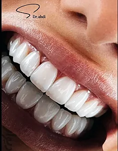 مطب دندانپزشکی دکتر فاطمه عبدی