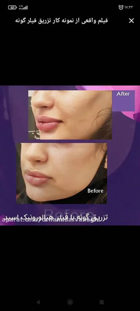 مطب دکترنفیسه زینعلی - تصویر 2