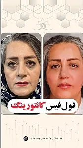 مطب دکتر نونا بزرگ زاده