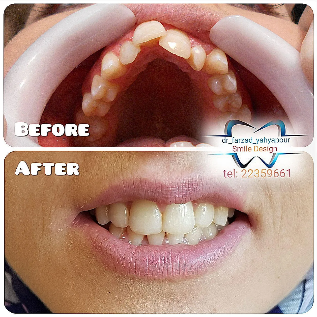 مطب ارتودنسی دکتر فرزاد یحیی پور - تصویر 3