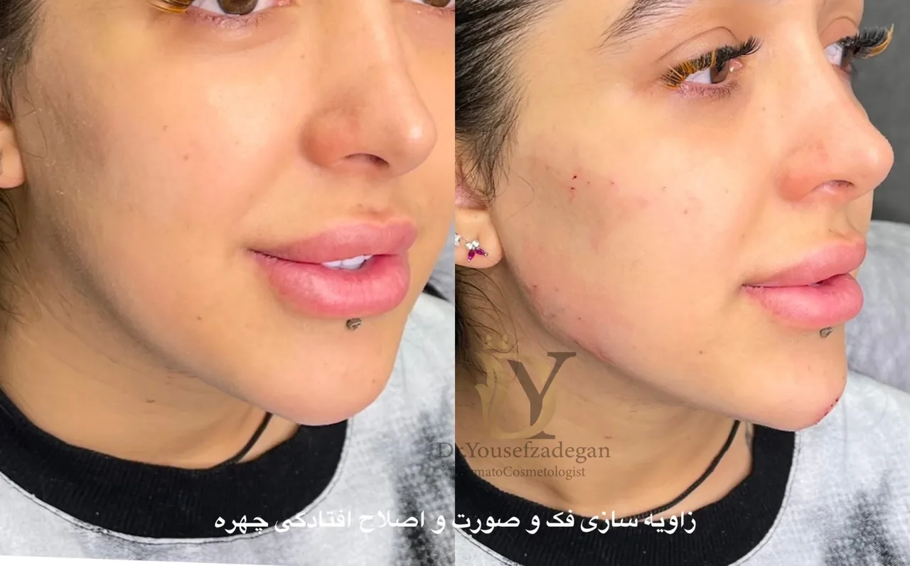 کلینیک زیبایی دکتر یوسف زادگان - تصویر 3