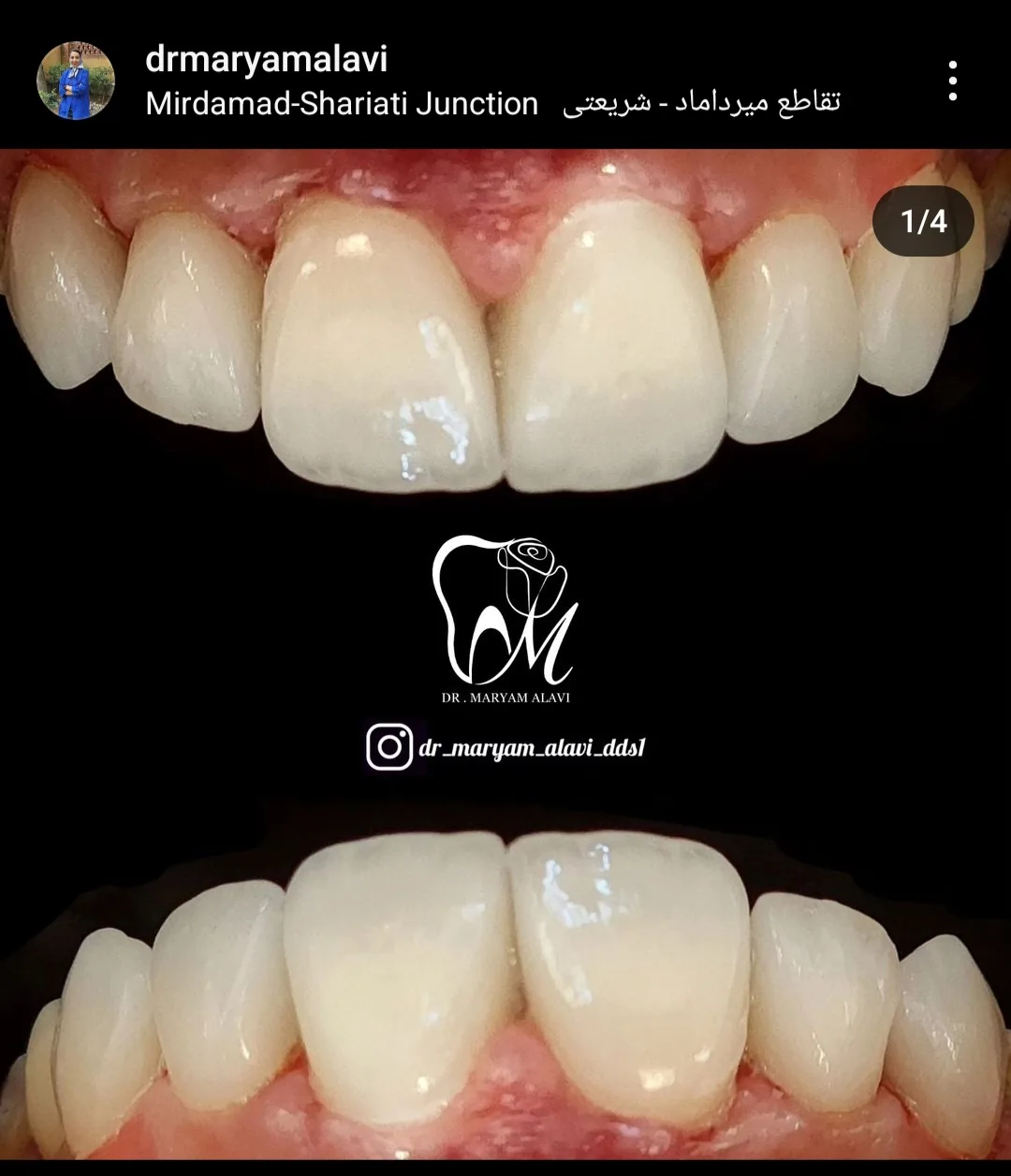 مطب دندانپزشکی دکتر مریم علوی - تصویر 4