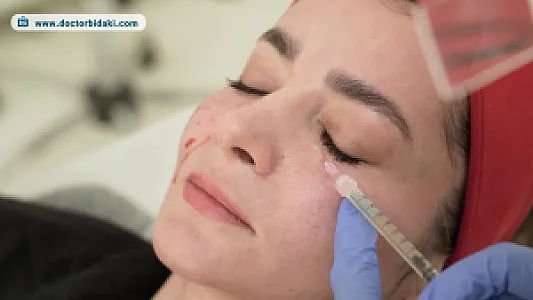 مطب دکتربیدکی