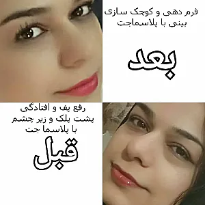 مطب پوست و زیبایی شفا