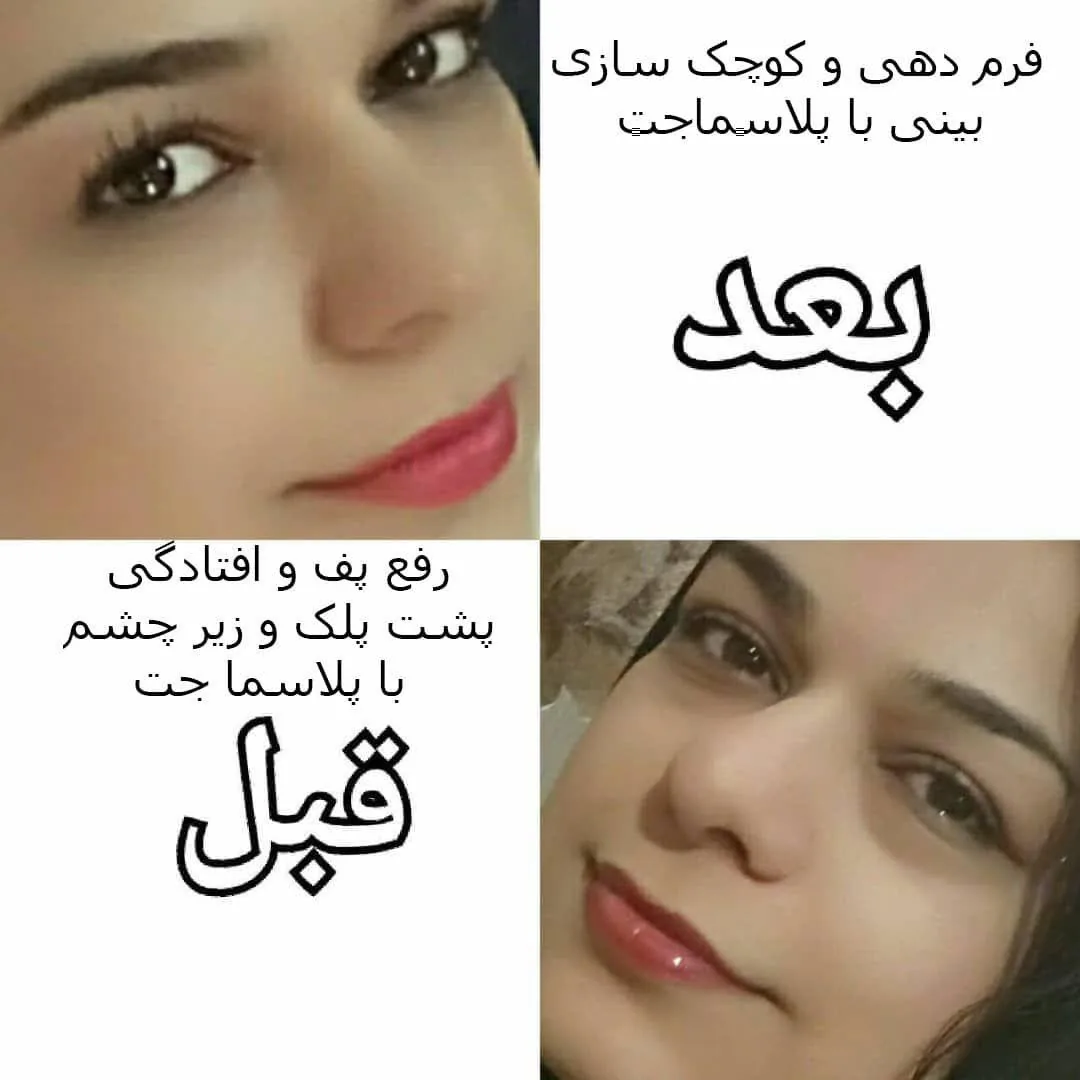 مطب پوست و زیبایی شفا