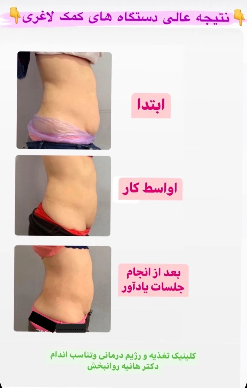 کلینیک تغذیه و رژیم درمانی و تناسب اندام (دکتر هانیه روانبخش)
