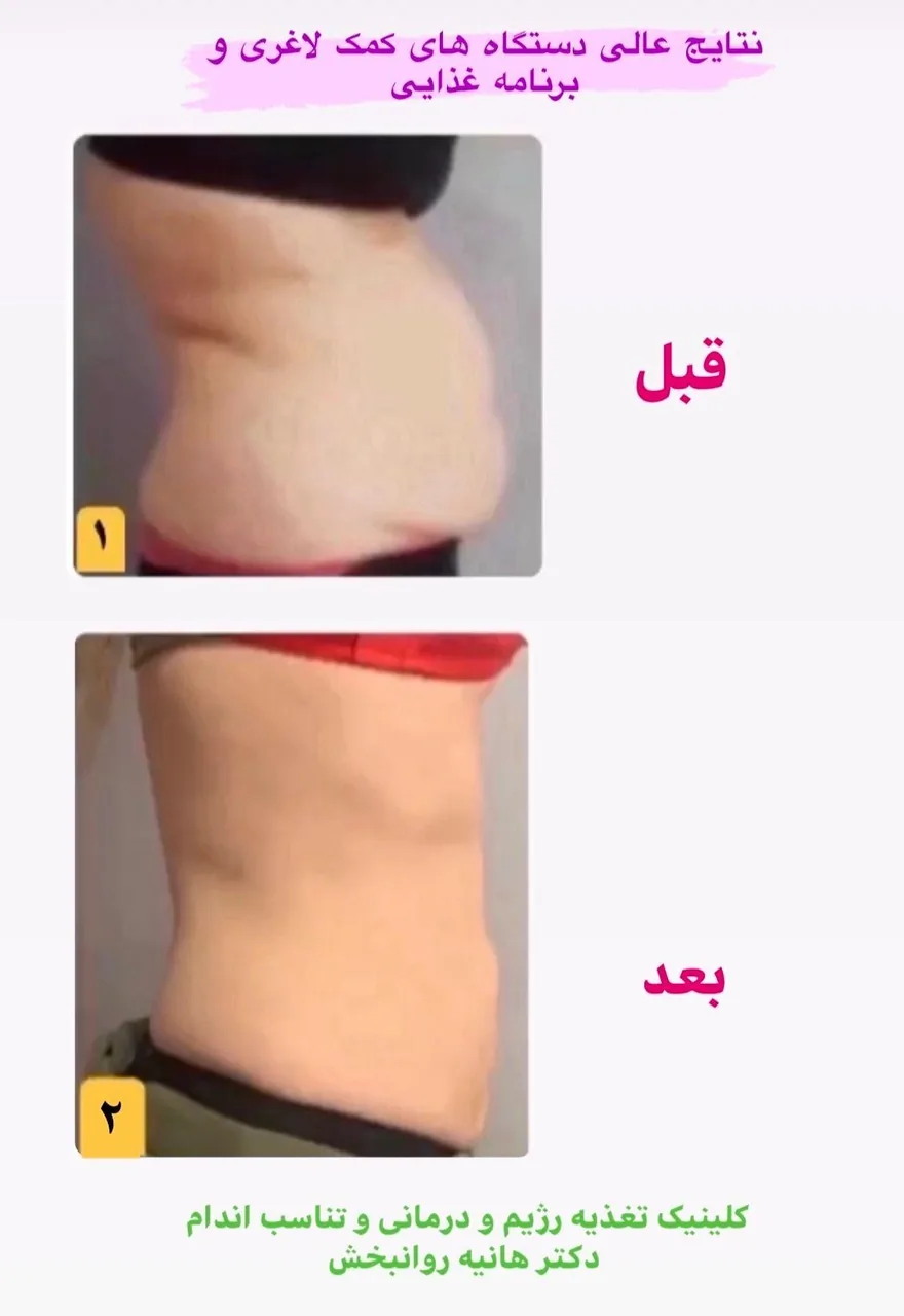کلینیک تغذیه و رژیم درمانی و تناسب اندام (دکتر هانیه روانبخش) - تصویر 2