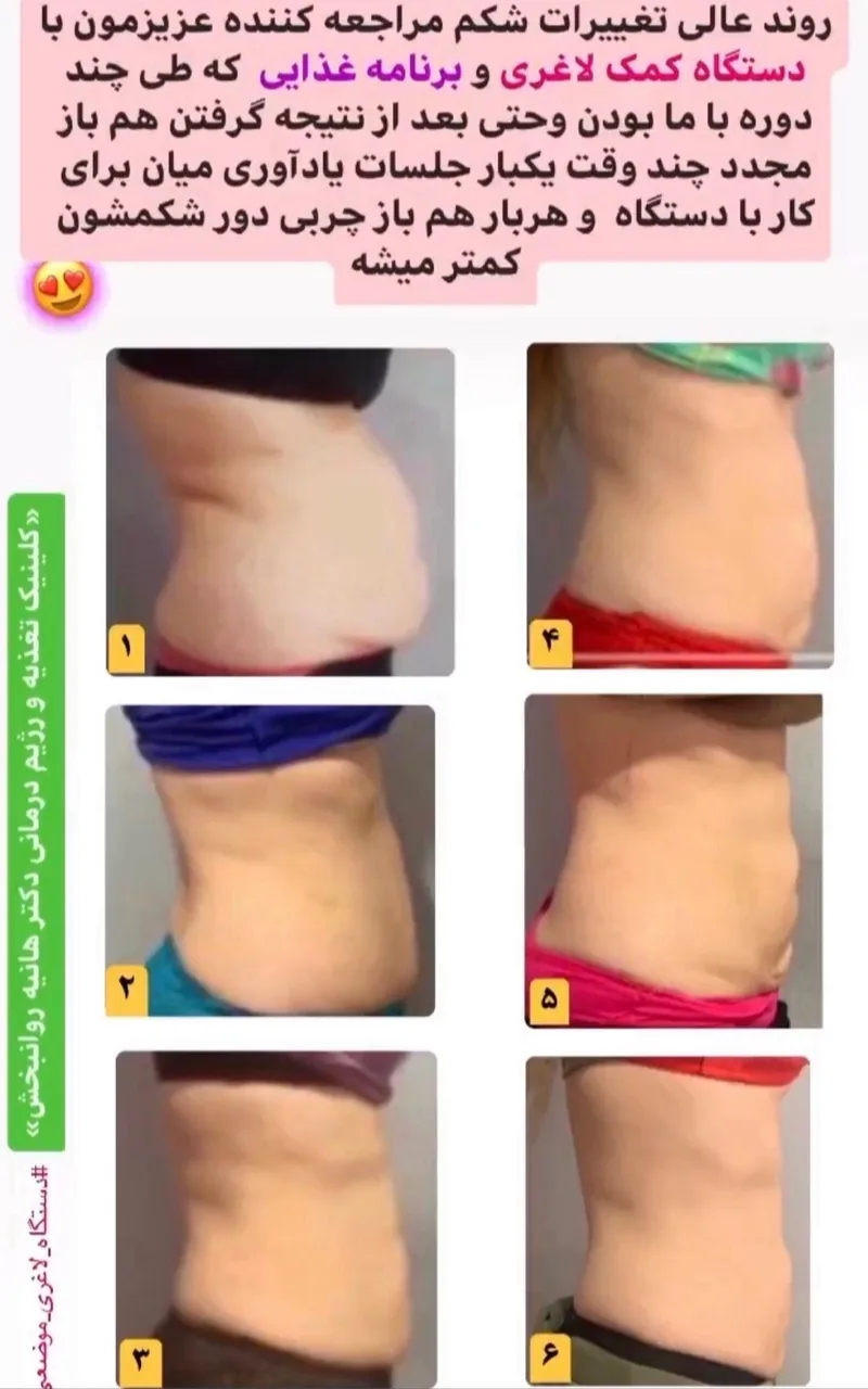 کلینیک تغذیه و رژیم درمانی و تناسب اندام (دکتر هانیه روانبخش) - تصویر 3