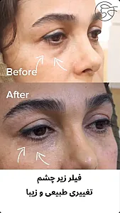 مطب زیبایی دکتر آرش هویدایی