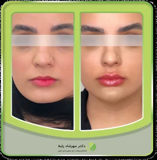 کلینیک پوست مو و زیبایی دکتر مهرشاد رابط - تصویر 2