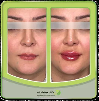 کلینیک پوست مو و زیبایی دکتر مهرشاد رابط - تصویر 3