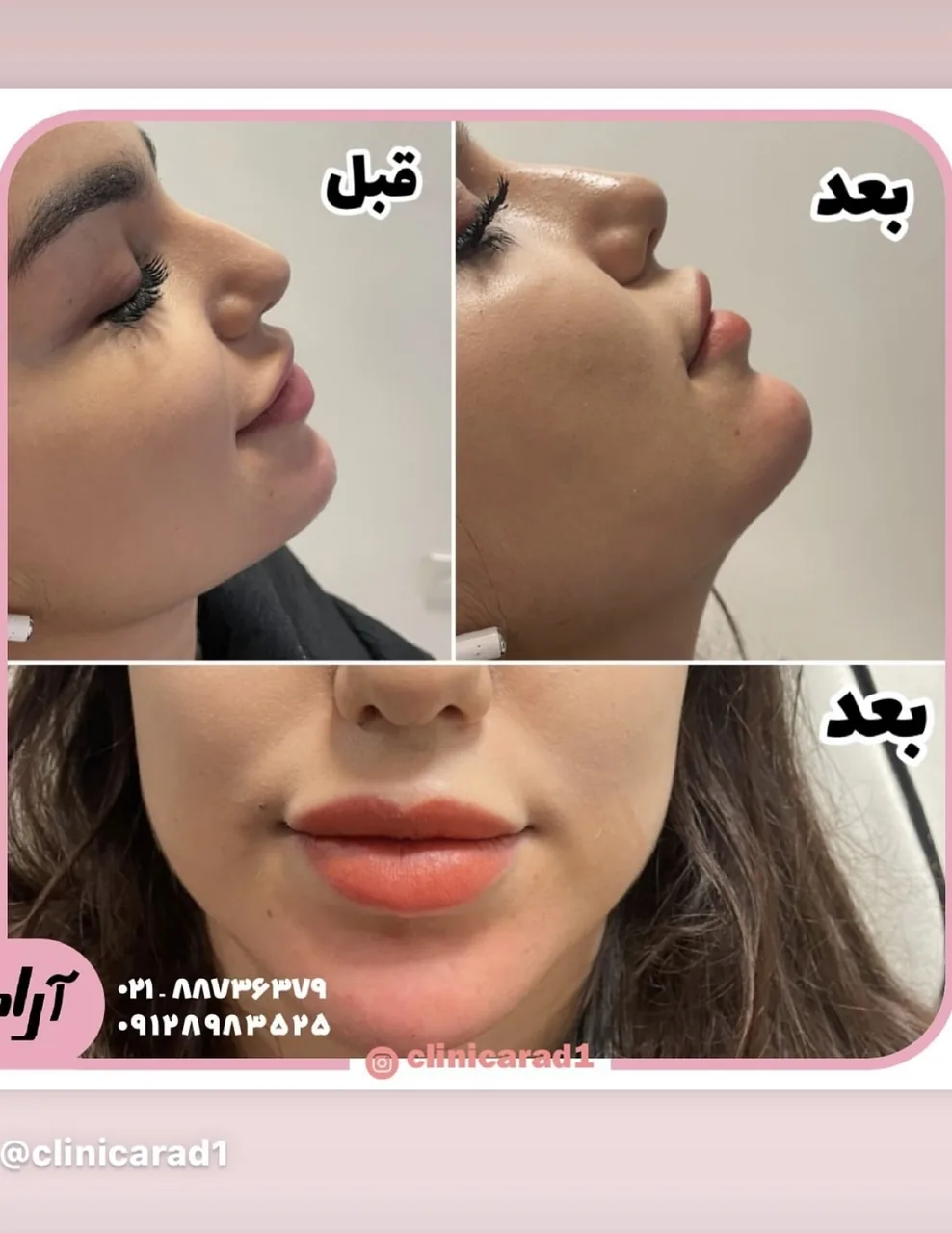 کلینیک زیبایی دکتر فریبا افتخار - تصویر 3