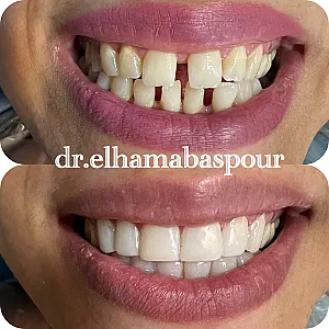 دندانپزشکی و زیبایی دکتر الهام عباسپور