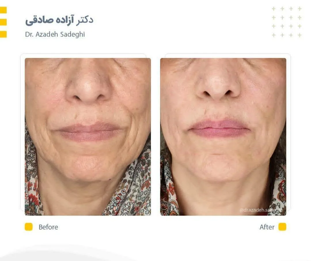 کلینیک زیبایی و لیزر دکتر آزاده صادقی