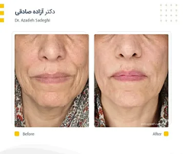 کلینیک زیبایی و لیزر دکتر آزاده صادقی