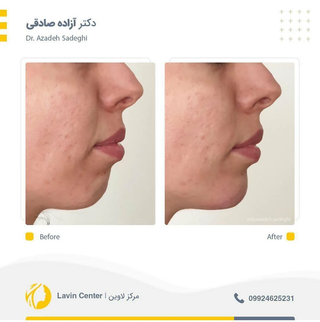 کلینیک زیبایی و لیزر دکتر آزاده صادقی - تصویر 2