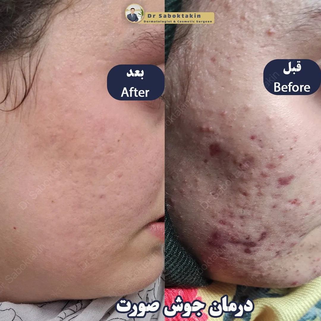 کلینیک پوست مو و لیزر دکتر مهدی سبکتکین - تصویر 2