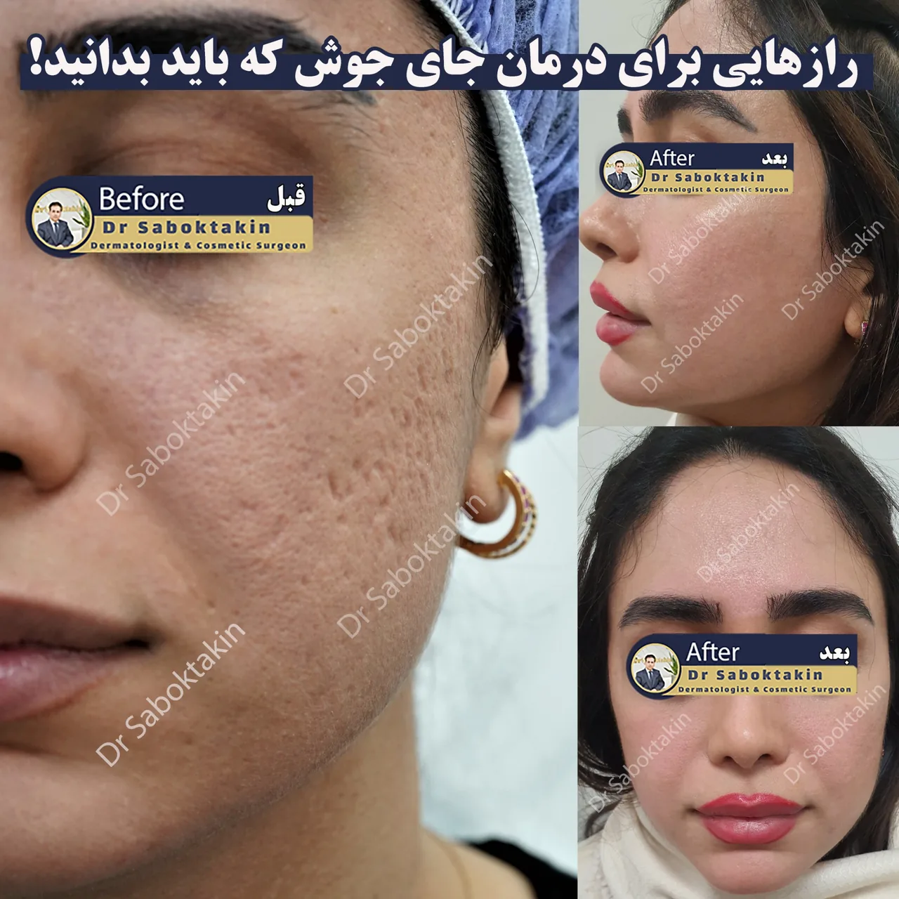 کلینیک پوست مو و لیزر دکتر مهدی سبکتکین - تصویر 3
