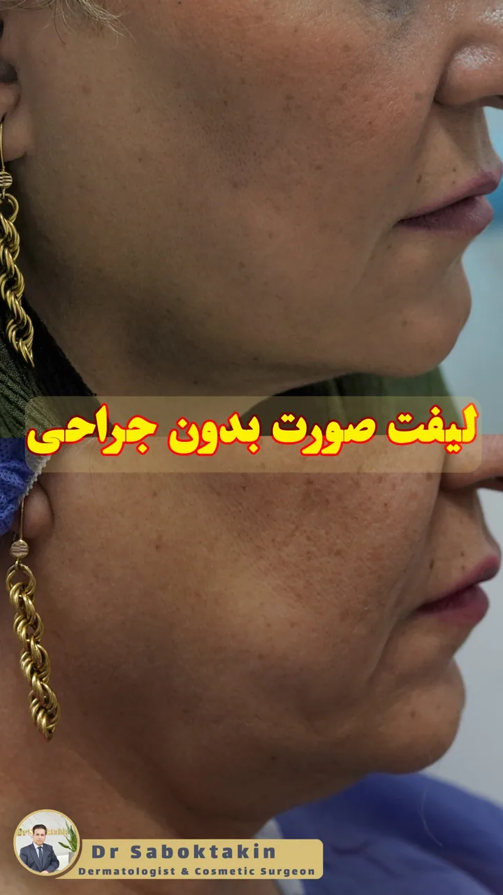 کلینیک پوست مو و لیزر دکتر مهدی سبکتکین - تصویر 4