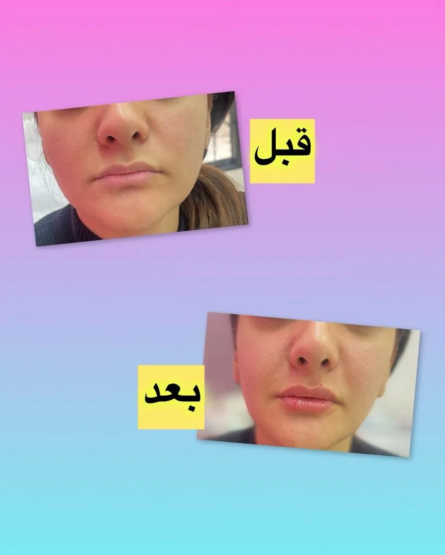 کلینیک زیبایی دکتر پوروزیری - تصویر 4