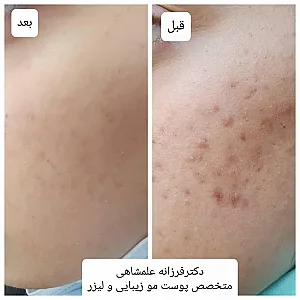 متخصص پوست مو زیبایی و لیزر (دکتر فرزانه علمشاهی)