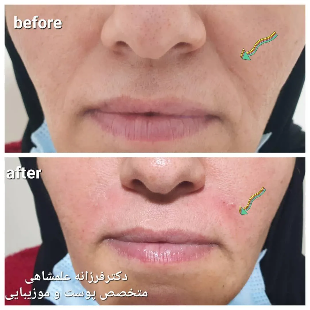 متخصص پوست مو زیبایی و لیزر (دکتر فرزانه علمشاهی) - تصویر 2