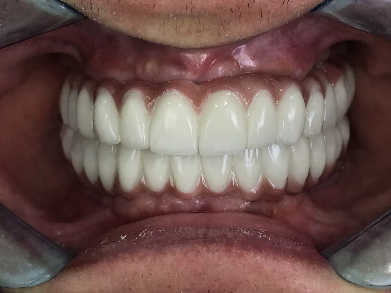 دندانپزشکی دکتر علی ضیائی متخصص ایمپلنت