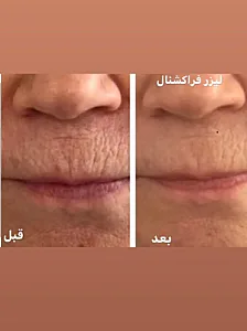 کلینیک تخصصی پوست دکتر مینا فتح آبادی