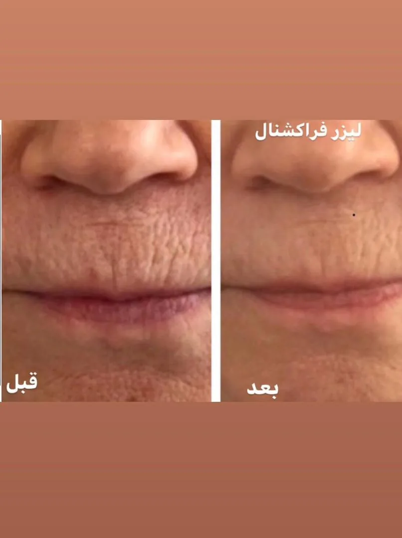 کلینیک تخصصی پوست دکتر مینا فتح آبادی
