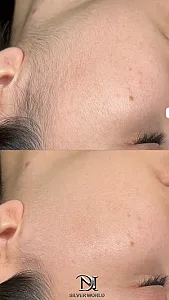 مرکز زیبایی مرکز لیزر دکتر سورنا رضوانی