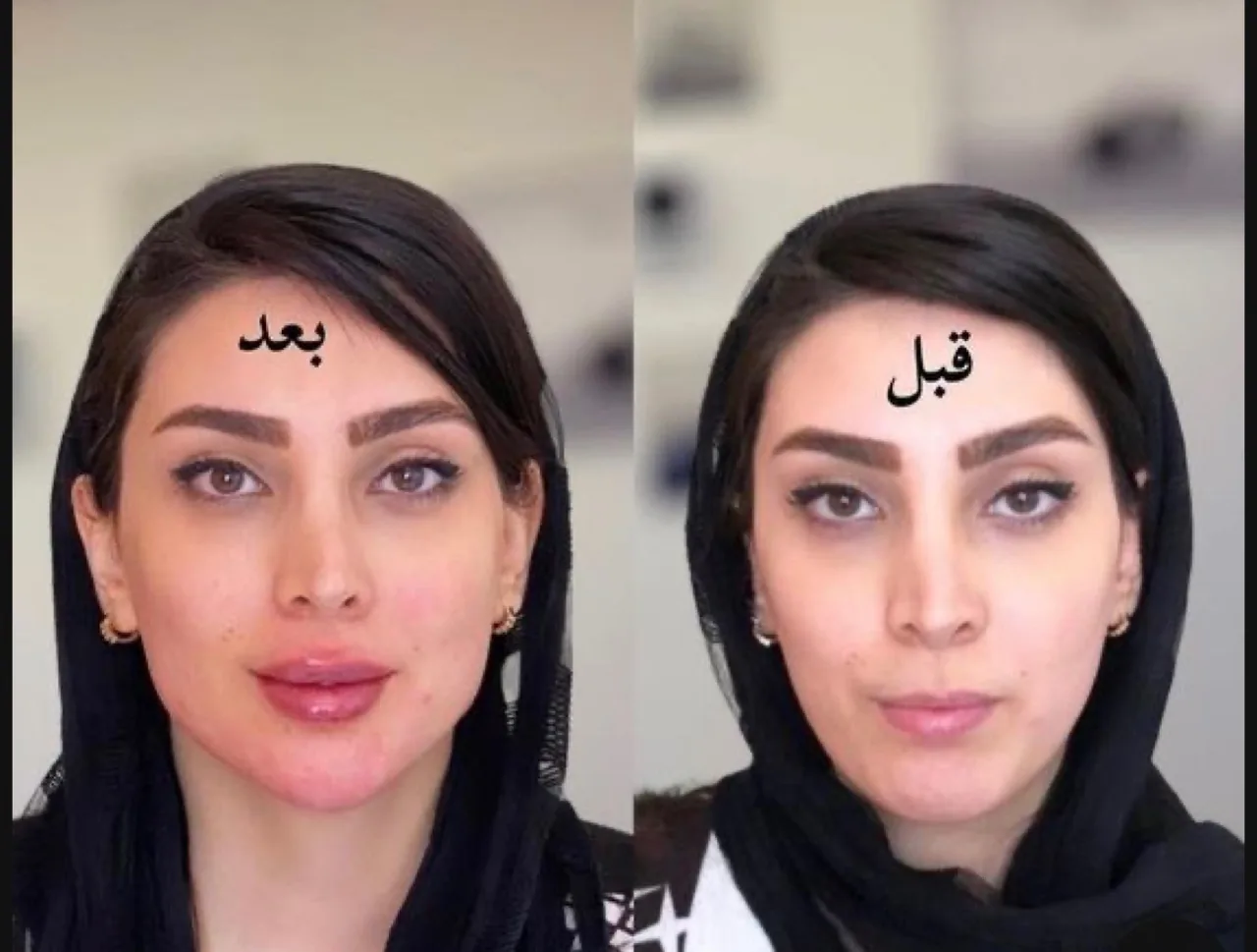 کلینیک پوست،مو و زیبایی دکتر منا زمزم - تصویر 3