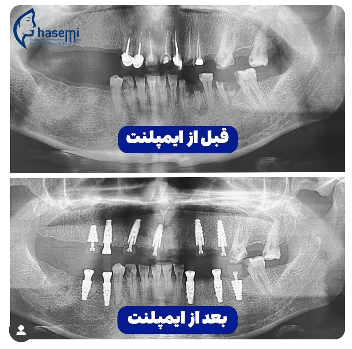 کلینیک  جراحی فک و صورت دکتر قاسمی - تصویر 2
