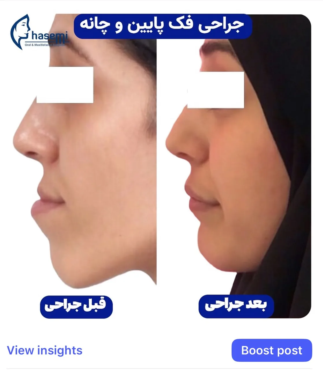 کلینیک  جراحی فک و صورت دکتر قاسمی - تصویر 3