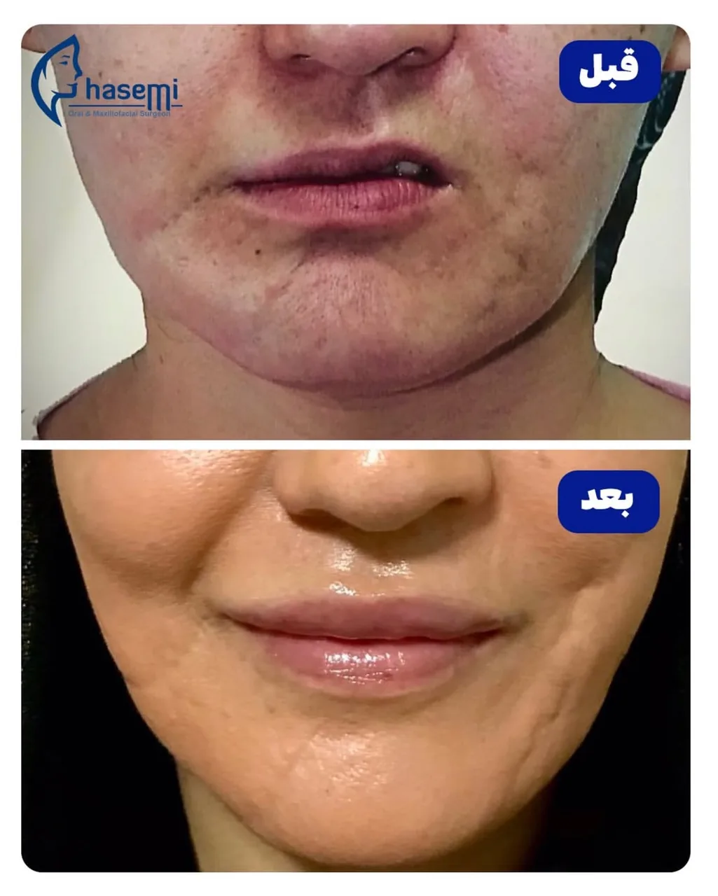 کلینیک  جراحی فک و صورت دکتر قاسمی - تصویر 4