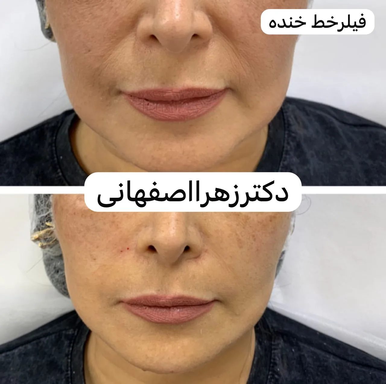 کلینیک پوست مو زیبایی دکتر زهرا اصفهانی - تصویر 2