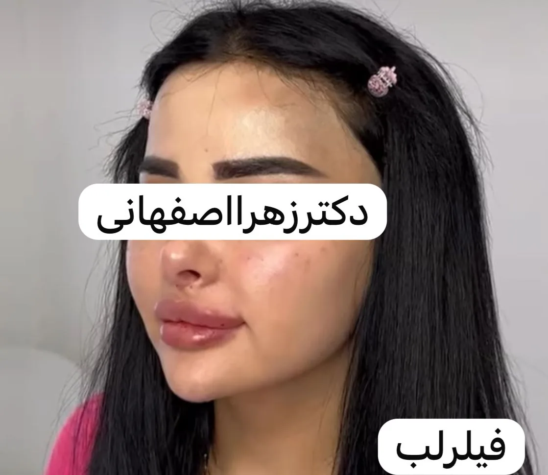 کلینیک پوست مو زیبایی دکتر زهرا اصفهانی - تصویر 4