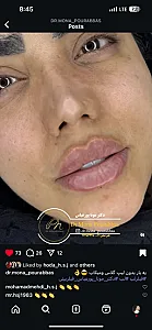 مطب پوست و زیبایی دکتر مونا پورعباس