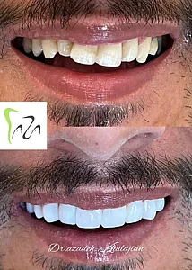 دندانپزشکی دکتر آزاده خلجیان