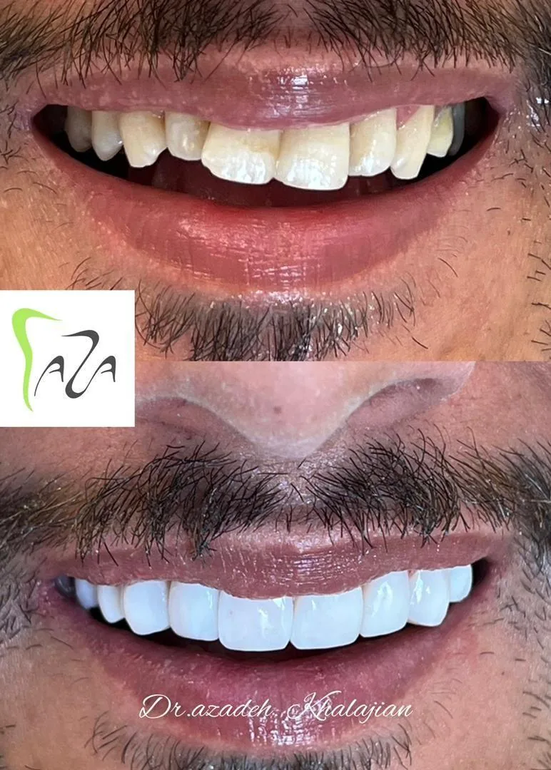 دندانپزشکی دکتر آزاده خلجیان